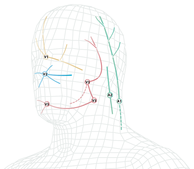 Schéma d’une tête en maillage représentant les trois branches du nerf trijumeau sur le visage : V1 au front, V2 à la joue, V3 à la mâchoire, et les nerfs occipitaux à l’arrière du crâne.